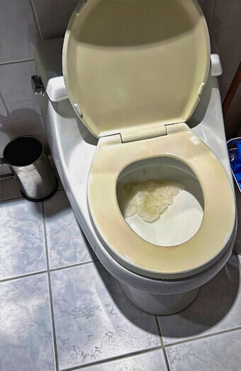 https://blockeddrainsnorthbeach.com.au/uploads/2025/07/blocked-toilet-27293.jpg